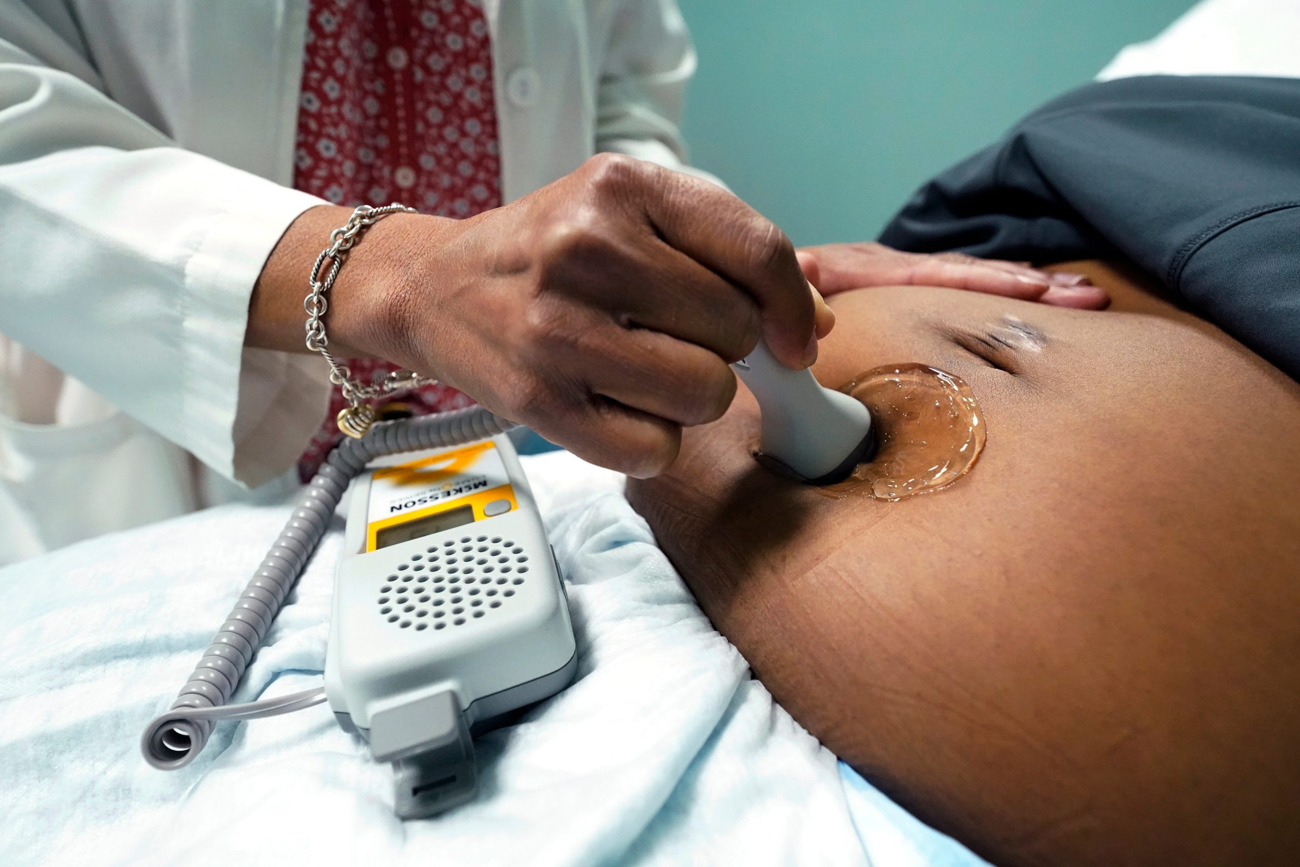 Minnesota has some of country’s lowest teen pregnancy rates – but worst racial disparities